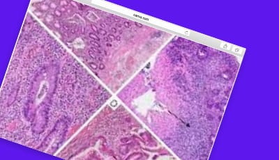 ai solution histology image recognition